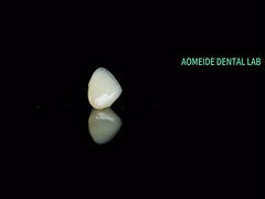 Κεραμική γέφυρα στέμματος