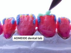 Δυνατότητα Φυσική αισθητική Σκληρό στέμμα από ζιρκόνια Ιδανικό για μονό ή πολλαπλά δόντια