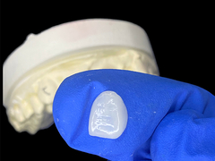 IPS e.max Φανίρες για το κόφτη στη σκιά A1 Φυσική αισθητική για τέλεια χαμόγελα