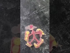 Ελαστική μερική οδοντοστοιχία Nesbit για άνεση και αντοχή στην αντικατάσταση δοντιών