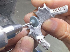 Τυφή μερική οδοντοστοιχία