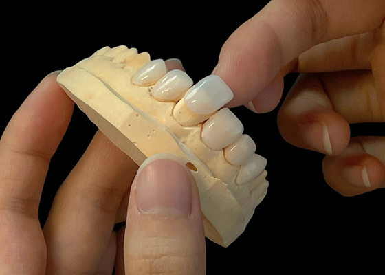 Αγορά Πορσελάνη Ultra Thin Veneers EMAX Ανθεκτικό στα λεκέτα για αισθητικές αποκαταστάσεις online manufacture