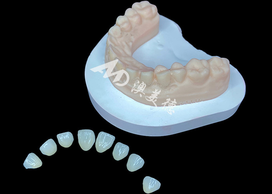 Αγορά Η IPS e.max Veneer Premium αισθητική λύση για εντυπωσιακά μετασχηματισμένα χαμόγελα online manufacture