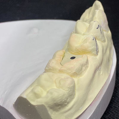 Αγορά Ενισχύστε την αποκατάστασή σας με την τεχνολογία Lock Pink Post Core online manufacture