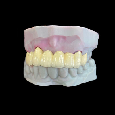 Αγορά Κράνος από πορσελάνη λιωμένη σε μέταλλο (PFM) με πλαίσιο Co-Cr online manufacture