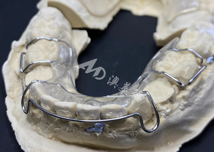 Εύκολο να φορέσετε το Hawley Retainer του AMD Dental Lab για ασφαλή και υγιή ορθοδοντική