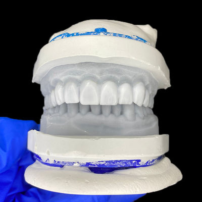 Καλή τιμή Diagnostic Wax-Up for Porcelain Veneers σε απευθείας σύνδεση