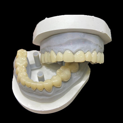 Καλή τιμή PMMA Temporary Restorations CAD/CAM PMMA Crowns and Bridges for Provisional Dental Cases σε απευθείας σύνδεση