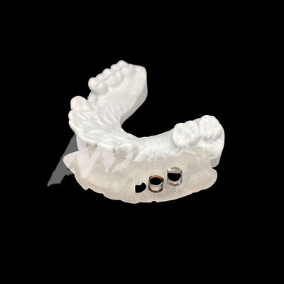 Καλή τιμή Ακριβής εφαρμογή 3D εκτυπωμένος χειρουργικός οδηγός εμφυτευμάτων με υψηλή αντοχή στην αποχρωματισμό χρησιμοποιώντας τεχνολογία αλεύρι CAD / CAM σε απευθείας σύνδεση